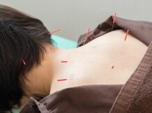 アール鍼灸整骨院の雰囲気(体の状態に合わせて鍼灸と整体で整えていきます。)