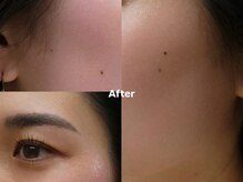 アイロンボーイ(IRONBOY)/艶肌お顔全体WAX