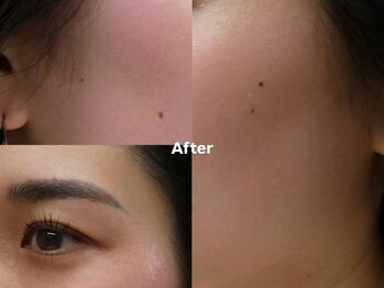 アイロンボーイ(IRONBOY)/艶肌お顔全体WAX