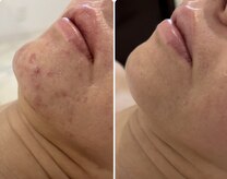 エステティック トリートメント クオリティ(Esthetic Treatments Quality)