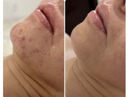 エステティック トリートメント クオリティ(Esthetic Treatments Quality)の写真