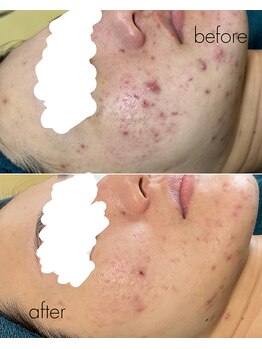 リノルーア(Linolua)/