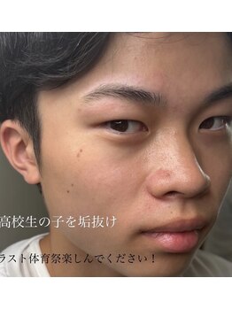 ダウニー(Downy)/10代/男性/学生