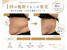 ルミナスの雰囲気（たった1回でも変化を実感されたお客様多数。）