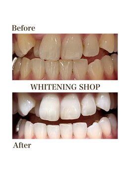 ホワイトニングショップ 尾道店(WHITENING SHOP)の写真/全国190店舗展開のセルフホワイトニング専門店!独自の最高品質ジェルで歯の黄ばみを解消♪