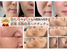 ハナ チュチュ(Hana chuchu)の雰囲気（最新美容プラズマであなたの肌悩みを解決します！）