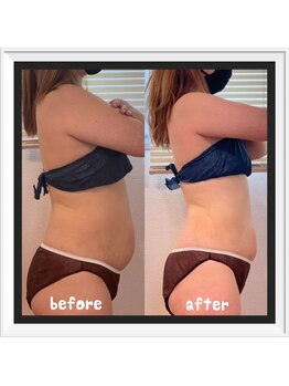 ソワン(soin)/★結果重視のサイズダウン★