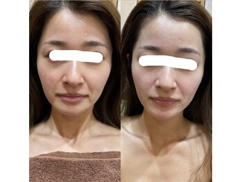 トゥーリ 春日店(tuuli)/ビフォーアフター