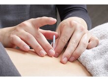 前橋miraie鍼灸整骨院(前橋ミライエ鍼灸整骨院)/施術風景[整体/小顔/前橋/群馬]