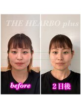 ハーボプラス(THE HEARBO plus)/更に小顔