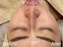 シェリーミル(Cherie Miru)/くすみ・ハリ減退・赤み・毛穴