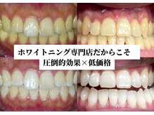 シャイニー(Shiny)の雰囲気（SALE特別割引実施中！！）