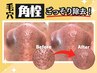 韓国式3D毛穴洗浄×炭酸パックで美白と水光肌に◎ ツヤツヤ仕上げ￥18000→