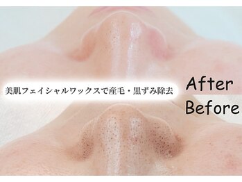 夏秋美肌サロン