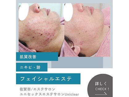 ユニクリア(Uni clear)の写真