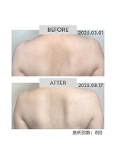 ボディプラス(BODY+)/★シーンに合わせた施術