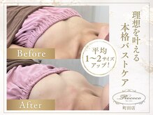 ロココ 町田店(Rococo)の雰囲気(20回でこの変化!満足度◎【町田/バストアップ】)