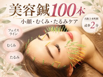 ソラナ(Solana)の写真/【上本町徒歩2分】美容鍼で肌質改善と小顔矯正♪《初めての方にもオススメ！》大阪美容鍼灸/むくみ改善！