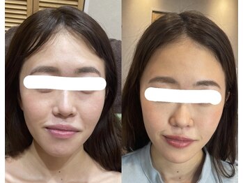 トゥーリ 春日店(tuuli)/ビフォーアフター