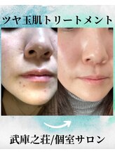 エデン(Eden)/艶肌トリートメント