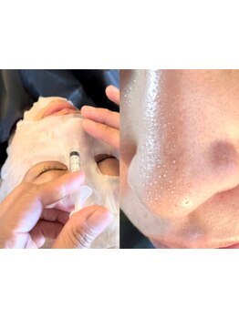 毛穴ケアをしたい