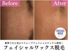 【平日10時～14時限定】フェイシャルワックス60分¥11000→¥7000