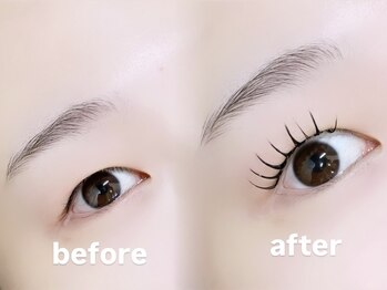 ロピ 江坂(LOPI)/&Healthy(アンドヘルシー)120本