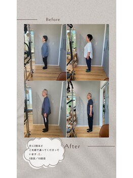 ラキピラティス かわたに接骨院(Lakipilates)/beforeafter