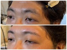 スリーピース(3Peace)/アーチ眉 Before/After