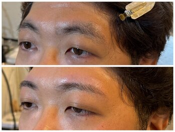 スリーピース(3Peace)/アーチ眉 Before/After