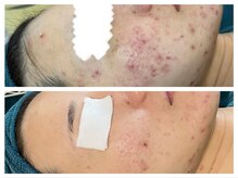 リノルーア(Linolua)