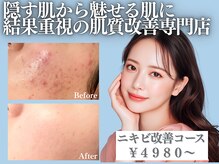 アクール(Accueil)