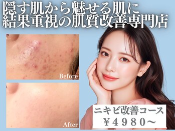 アクール(Accueil)