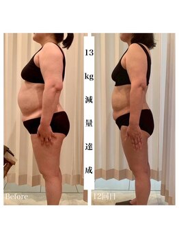 ルノン(Lunon)/《体質改善》腸活＆痩身　