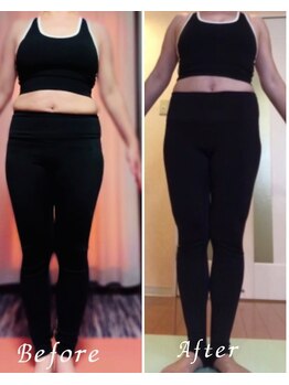 ジュノ(JUNO)/Before After