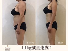 エターナルフレーム(Eternal Flame)