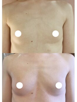 プレジール/バストボリュームアップ