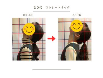 ストレッチ 整体 ホープ(HOPE)/ストレートネック矯正得意です