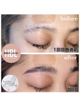 リノア 心斎橋店(LINOAH)/ハリウッドブロウリフト &nbsp;b → a