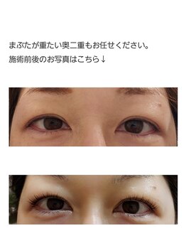 アロマスイーツ(AromaSweets)/まつげパーマ/まつ毛パーマ