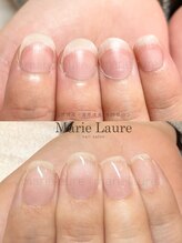 マリーロール 梅田店(Marie Laure)/深爪矯正/自爪育成/ネイルケア