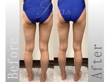 ステラ(STELLA)/下半身プレミアムの効果