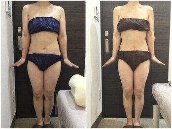 美容整体ウェリナ 名駅院/小顔矯正/骨盤矯正/美脚サロン