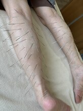 せせらぎ鍼灸院/