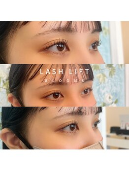 ブルームエイト(Bloom8)/