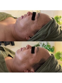 シーアイエステティック 船橋駅前店(c.iエステティック)/メンズフェイシャル★