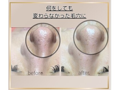 ハルハル(Haru Haru)の写真