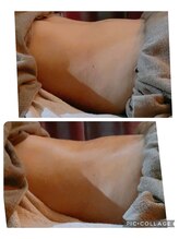 ヴァローレ(valore)/ガスがたまりやすいお腹