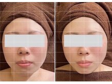 サロン リーナ 北千住店(Salon Lena)/商標登録手技★骨造コルゾウ