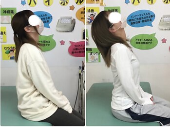 藤接骨院 浜松東院/真上を向けない首の痛みが楽に♪